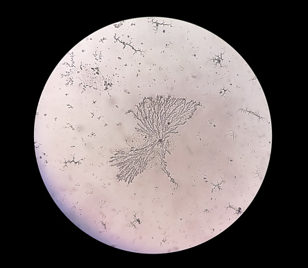 Microscopic view of dermatophytes, Nail scraping for fungus test, 40X