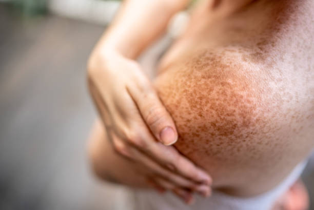 Close-up of a shoulder of a adult woman at spa Close-up of a shoulder of a adult woman at spa skin feature stock pictures, royalty-free photos & images