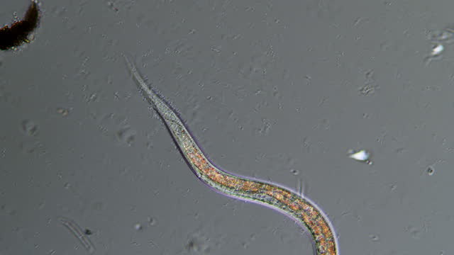Microscopy of Nematode worm