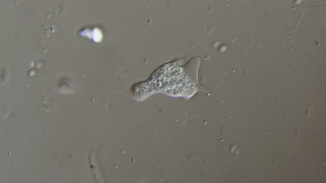 Microscopy of Amoeba