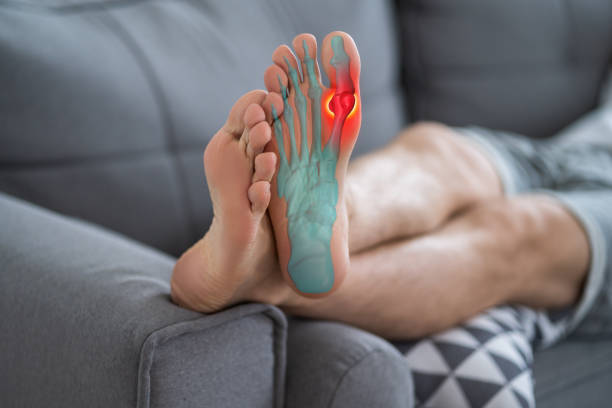 Joint diseases, hallux valgus, plantar fasciitis, man's leg hurts, pain in the foot Joint diseases, hallux valgus, plantar fasciitis, man's leg hurts, pain in the foot, health problems concept sprained big toe stock pictures, royalty-free photos & images