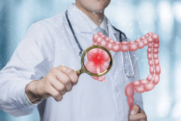 Doctor to examine with a magnifying glass intestines for bacteria . stock photo