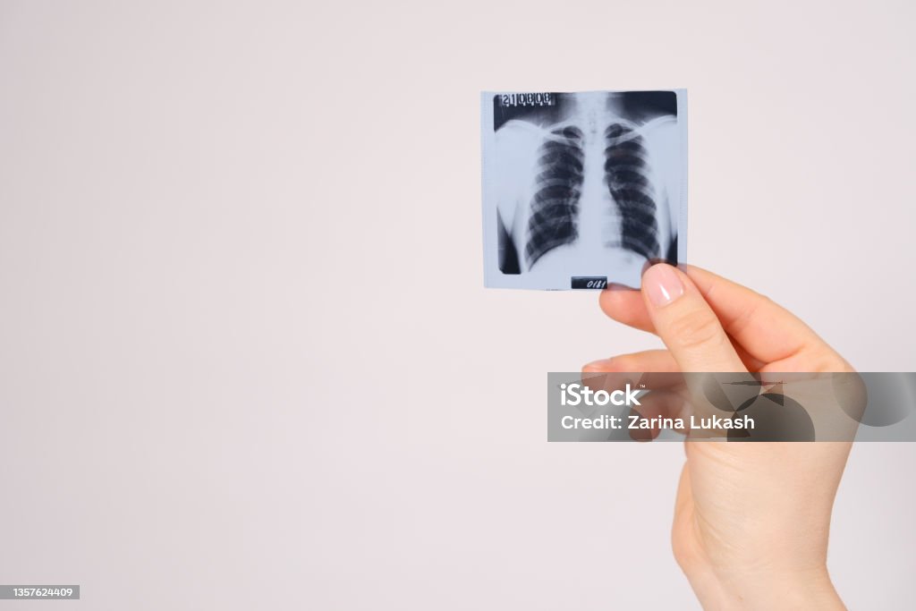 A snapshot of a fluorogram of the lungs in hand, space for text. - Royalty-free Röntgen Filmi Stok görsel