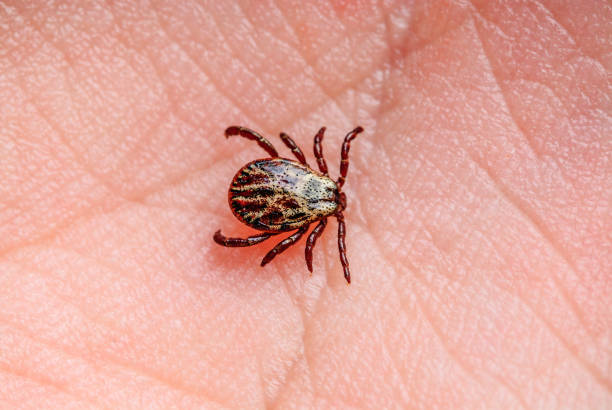 infectious encephalitis tick insect on skin. encephalitis virus or lyme borreliosis disease infected dermacentor tick arachnid parasite bite close-up. - lyme disease imagens e fotografias de stock