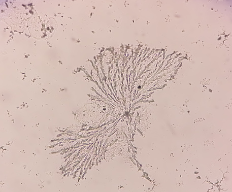 Microscopic view of Dermatophytes. Nail scraping fungus. 100X