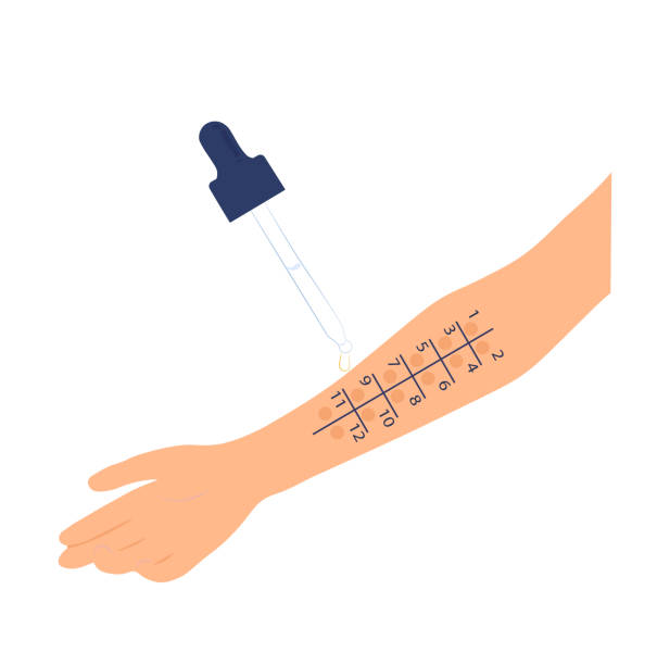 Allergy test vector stock illustration. Laboratory diagnostics for allergens by the drug. Allergy test vector stock illustration. Laboratory diagnostics for allergens by the drug. An injection test on the arm. Isolated on a white background. skin exame stock illustrations