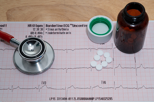 An ECG test chart with pills and a stethoscope