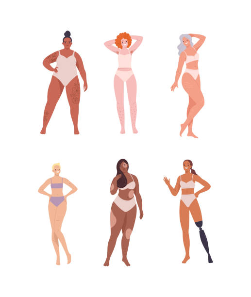Body-positive women collection. Vector illustration of pretty women of diverse ages, ethnicities, and body types, standing in casual underwear. Isolated on white vitiligo stock illustrations