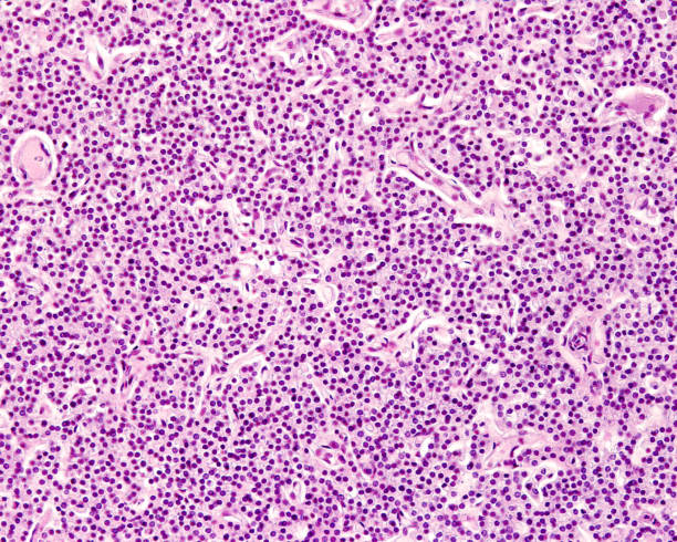 istock Child parathyroid gland 1357842855
