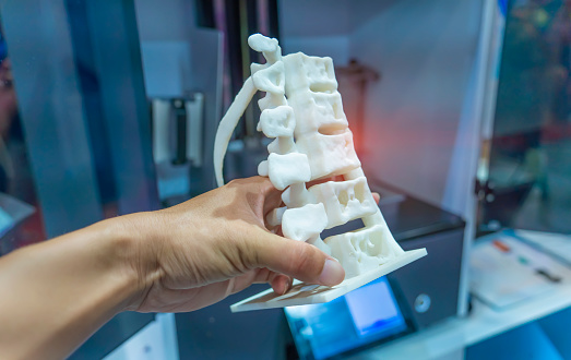 mano con columna vertebral humana impresa en 3D en impresora 3D. photo