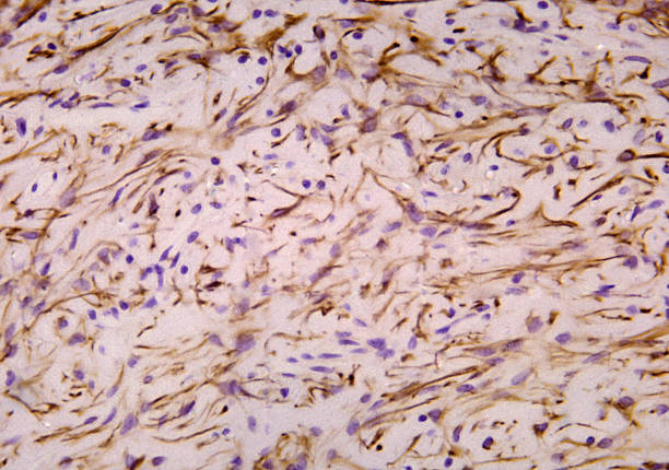 istock Posterior pituitary gland. Pituicytes. Vimentin 1357872227
