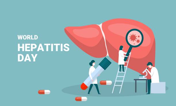 konsep hepatitis a, b, c, d, sirosis, hari hepatitis sedunia. dokter kecil merawat hati. ilustrasi vektor. - hepatitis ilustrasi stok