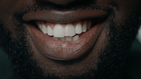 Extreme closeup bearded man smiling camera. Macro shot male person white teeth. Adult guy showing teeth. Young african american man teeth. Man face beard. Dentistry concept