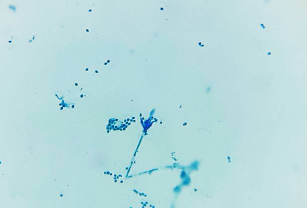 penicillium sp. - penicillium fotografías e imágenes de stock