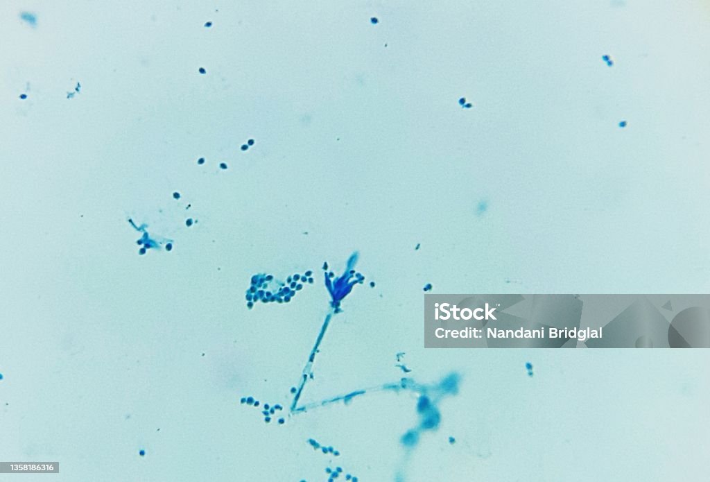 Penicillium sp. Penicillium sp. under a light or compound microscope as seen at objective x40. To visualize the Penicillium fungi, cotton blue due was used to stain the organism. Penicillium Stock Photo