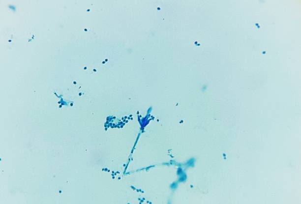 Penicillium sp. Penicillium sp. under a light or compound microscope as seen at objective x40. To visualize the Penicillium fungi, cotton blue due was used to stain the organism. conidiophore photos stock pictures, royalty-free photos & images