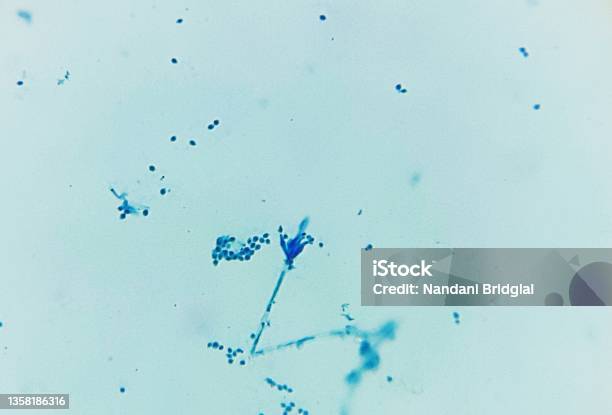 Penicillium Sp Stock Photo - Download Image Now - Penicillium, Microscope, Conidiospore