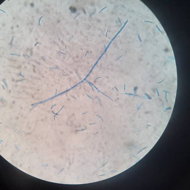 fusarium sp. - soil saprophyte - fotografias e filmes do acervo