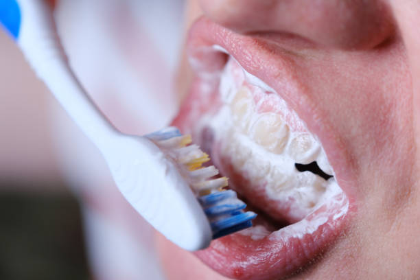 Broken tooth, missing teeth in open human mouth close up macro photo. Dental problems, dentistry medicine concept.