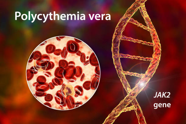 Polycythemia vera, a rare slow-growing blood cancer with an increase in the number of red blood cells Polycythemia vera, a rare blood cancer with an increase in the number of red blood cells in the body due to mutation in the JAK2 gene, 3D illustration showing abundant erythrocytes inside blood vessel erythropoietin stock pictures, royalty-free photos & images