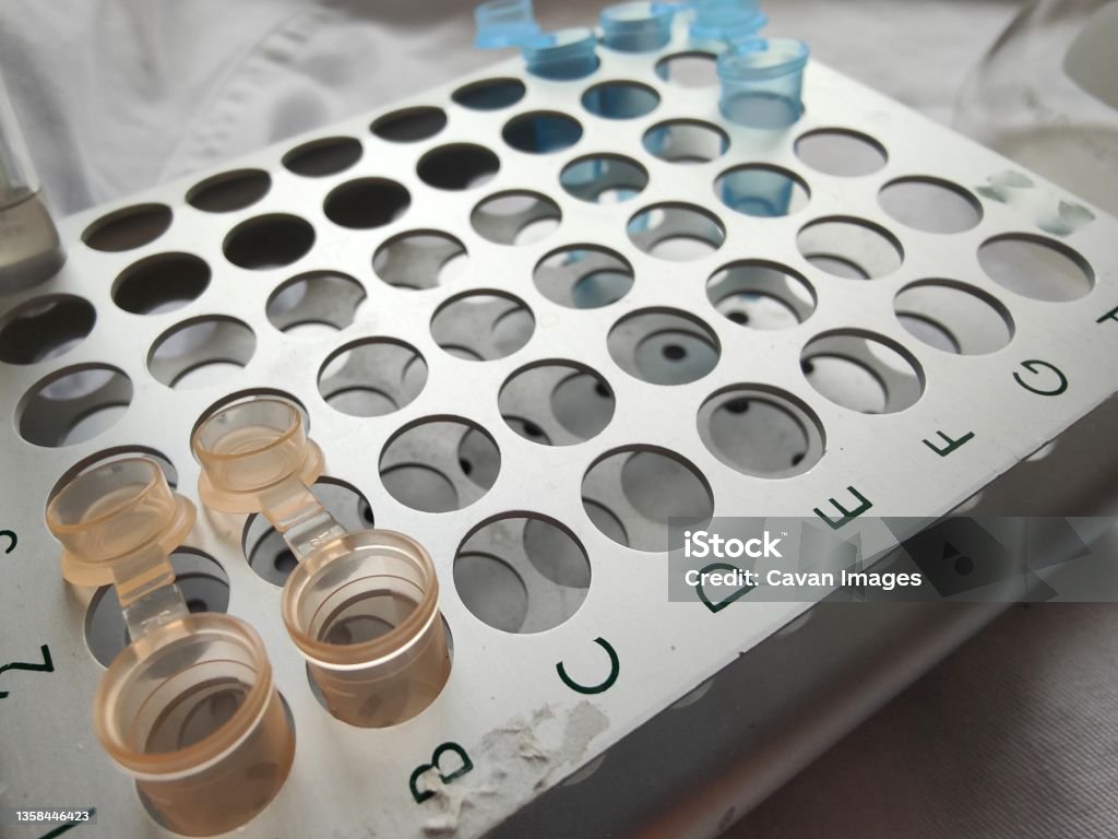 Sample Test Tray Lab Tray For Classifying Laboratory Samples Stock Photo - Download Image ...