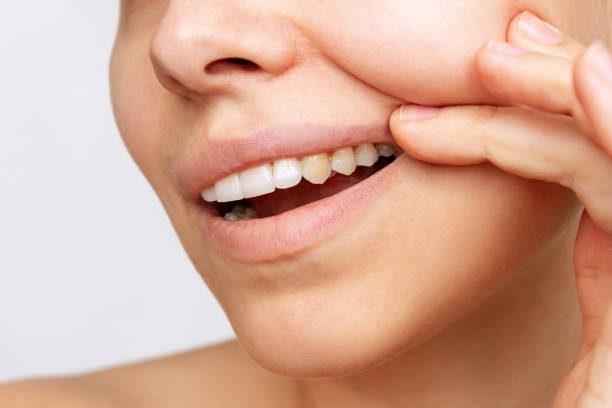 若い女性のクロップドショットは黄色い牙を示しています。ダークトゥースエナメル,コントラスト - human teeth ストックフォトと画像