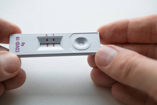 Rapid antigen detection test (RADT) with two red stripes showing a POSITIVE result of a human sample testing. Mans fingers holding the white plastic device with a COVID-19 Ag inscription. stock photo