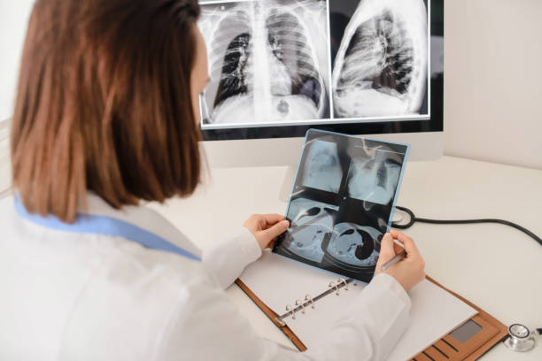 istock Young woman radiologist doctor analysis x-ray 1358723466