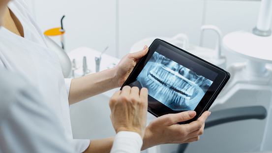 Dentista mostrando imagen de rayos X a su paciente photo