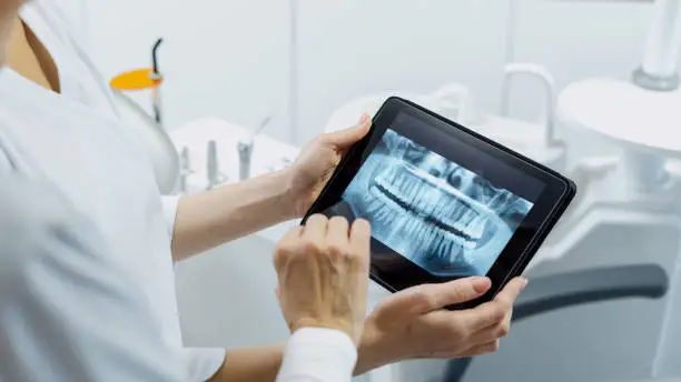 Photo of Dentist showing x ray picture to her patient