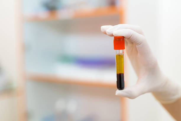 hand in white latex gloves holding blood sample vial in modern clinic background. closeup - multi well trays imagens e fotografias de stock