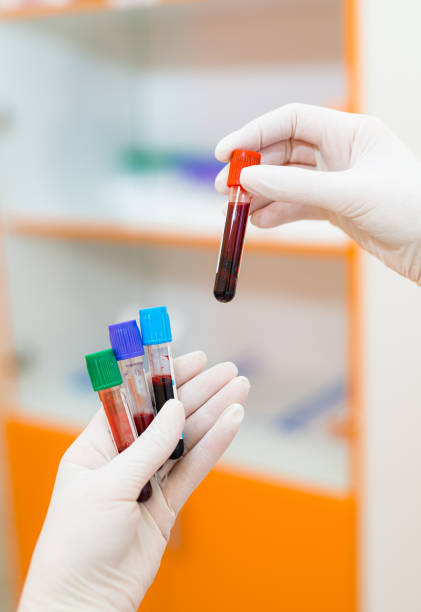 medical equipment. blood test. technician holding blood tubes tests in the research laboratory - multi well trays imagens e fotografias de stock