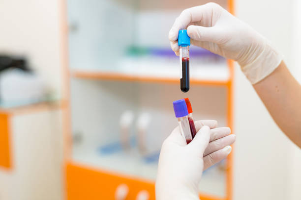 blood test at a medical clinic. nurse in special uniform, white latex gloves holding test tubes. selected focus - multi well trays imagens e fotografias de stock