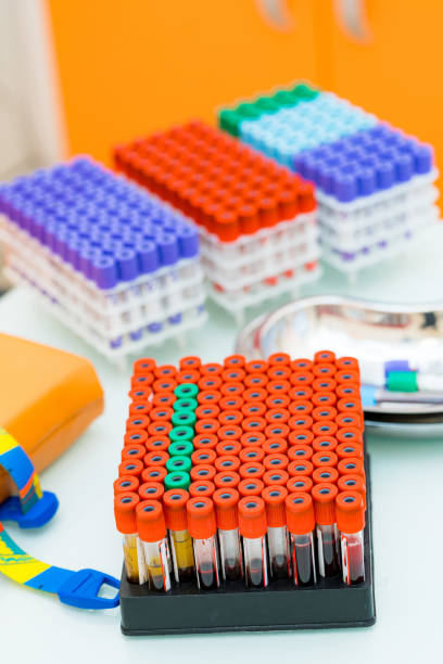 istock Blood samples test tubes in medical laboratory. Modern medicine testing analises. 1358911253