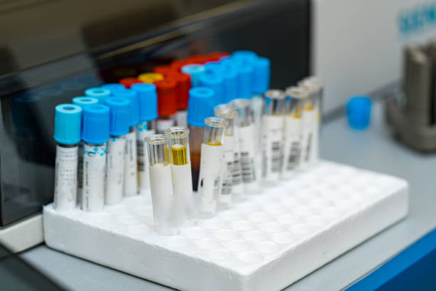 istock Modern medicine testing analises. Blood samples test tubes in medical laboratory. 1358911370