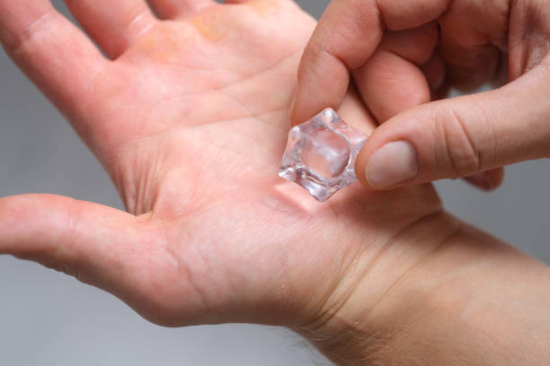 istock A man's hand is rubbing calluses with an ice cube 1358924755