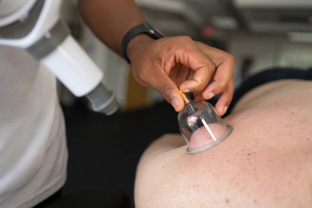 istock Professional performing vacuum cupping therapy on a client 1359061058