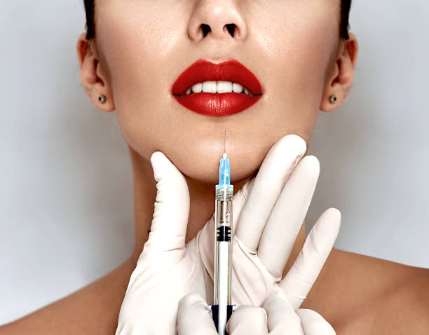 잘려 관능적인 여성 입술, 절차 입술 확대 - healthcare and medicine beauty spa botox injection hyaluronic acid 뉴스 사진 이미지