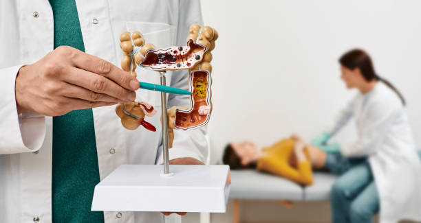 Anatomical intestines model with pathology in doctor hands. Gastroenterologist palpates patient abdomen and examines belly at clinic over background stock photo