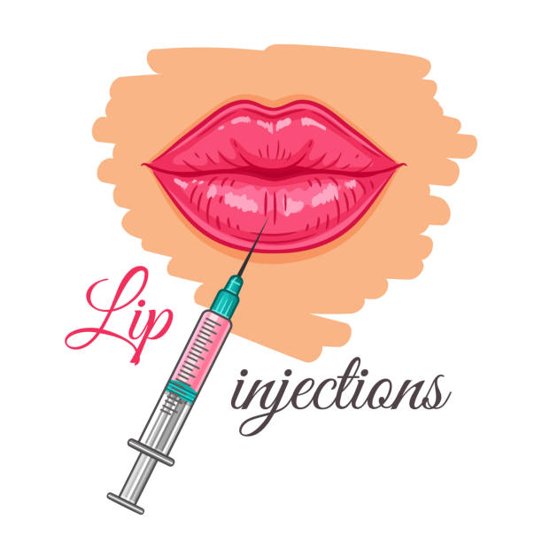Lip syringe injection for augmentation by hyaluronic acid filler. Medical beauty face procedure. Cosmetological correction woman mouth. Skin lifting and rejuvenation. Aesthetic plastic surgery. Vector Lip syringe injection for augmentation by hyaluronic acid filler sign. Medical beauty face procedure. Cosmetological correction form and volume of woman mouth. Cosmetic skin lifting and rejuvenation. Aesthetic plastic surgery. Hand drawn vector silicone implants stock illustrations