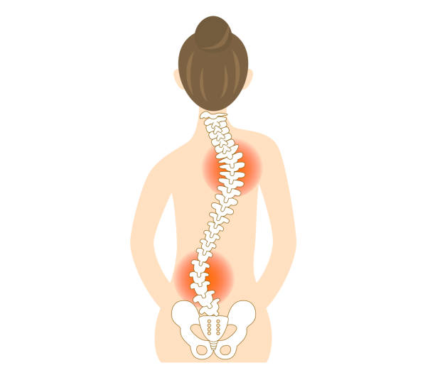 Human Spine Posture Back View Stock Illustration - Illustration of health,  medical: 118485762