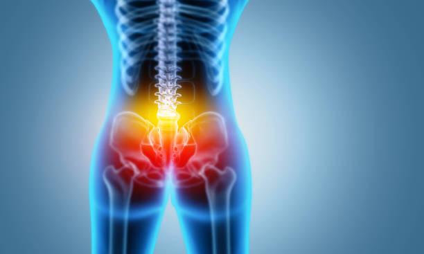radiografía del esqueleto doloroso de la cadera. concepto médico. ilustración 3d - sacrum fotografías e imágenes de stock