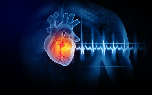 Ataque cardíaco y enfermedad cardíaca. Ilustración 3D photo