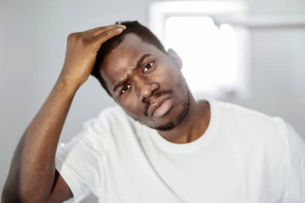 homem preocupado com a queda de cabelo - mirror men depression african descent - fotografias e filmes do acervo