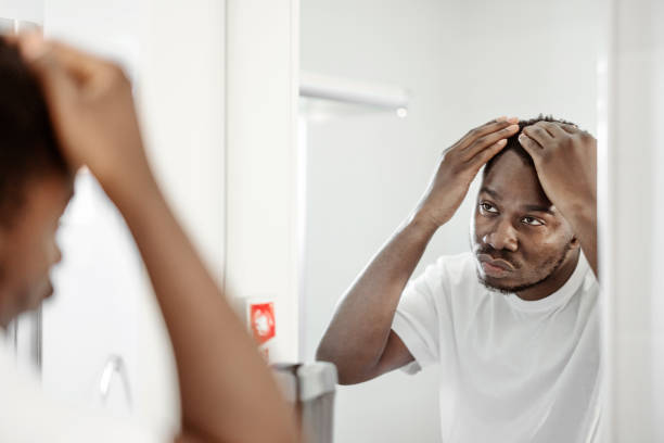 homem preocupado com a queda de cabelo - mirror men depression african descent - fotografias e filmes do acervo