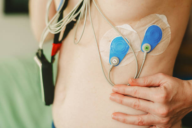 istock Holter monitor installed on young woman's chest 1359374673