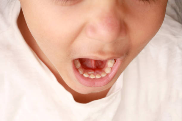 istock child, tooth, pediatric dentist 1359408943