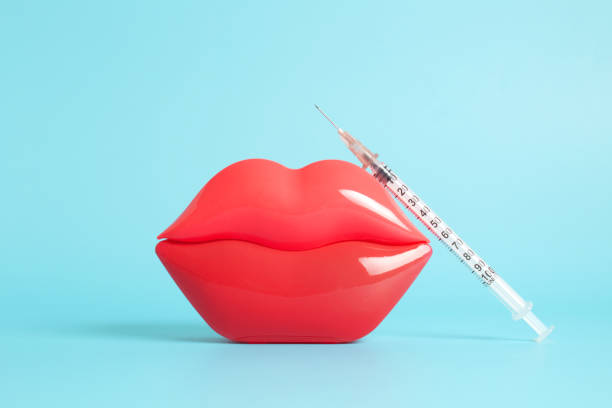 Bright red plastic female lips and a filler and hyaluronic acid injection syringe on a light blue background Bright red plastic female lips and a filler and hyaluronic acid injection syringe on a light blue background. fillers stock pictures, royalty-free photos & images