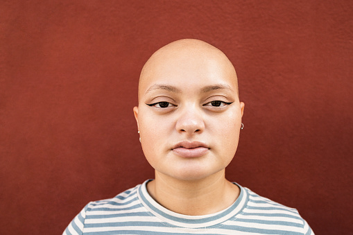 30,000+ Bald Head Pictures | Download Free Images on Unsplash