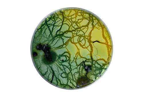 Petri dish or culture media with bacteria on white background with clipping, Test various germs, virus, Coronavirus, Corona, COVID-19, Microbial population count.
